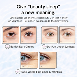 The Kralis™ Under-Eye Hydration Therapy Masks